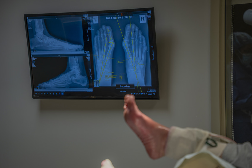 Écran qui affiche une radiographie du pied avec le pied du patient en avant-plan