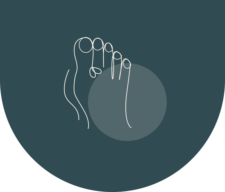 Hallux valgus