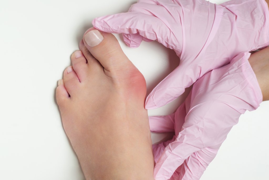 La Chirurgie de l'Oignon: Mythes ou Réalité